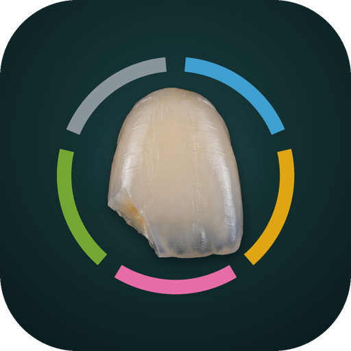 Ceramic Repair Guide